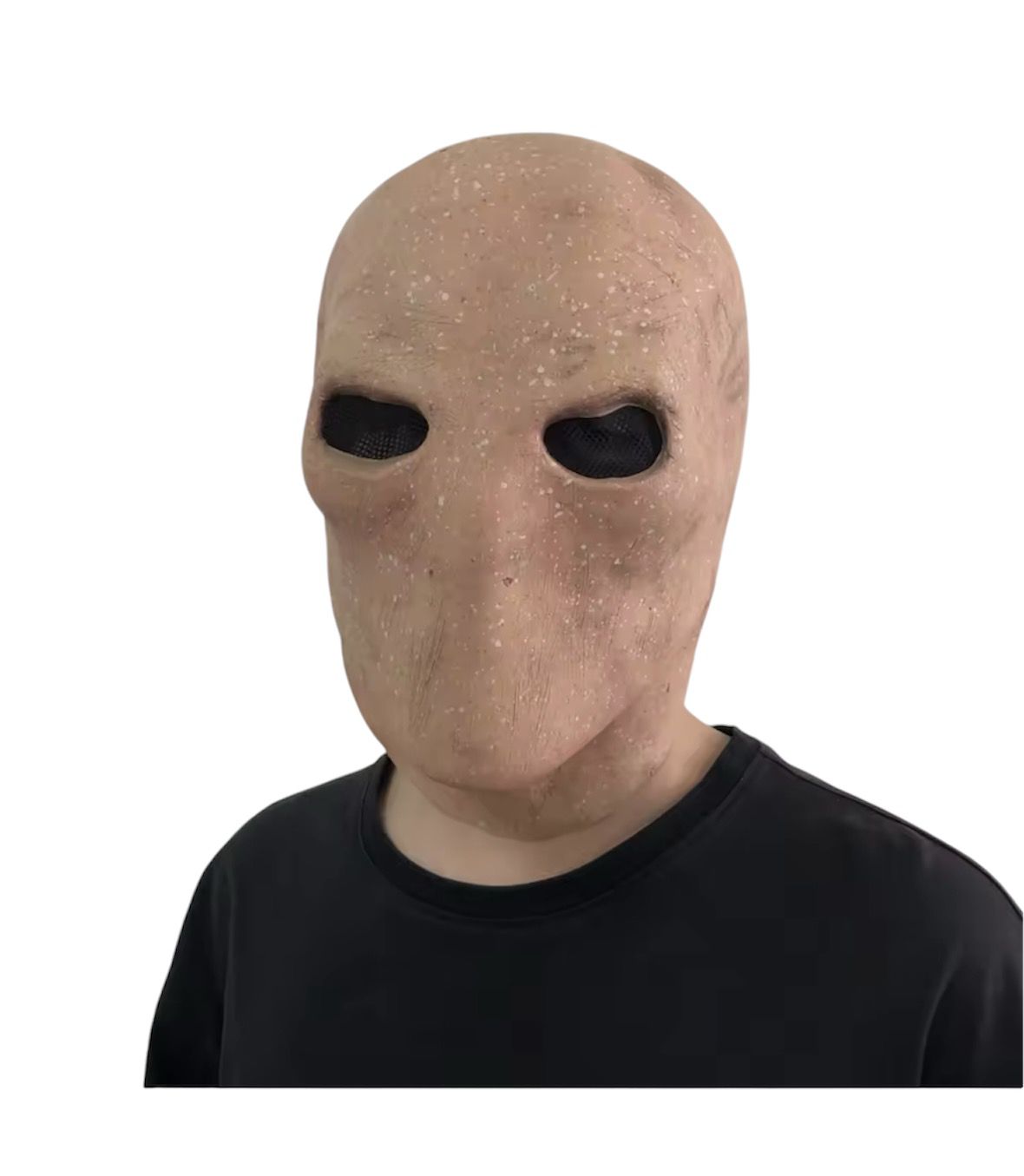 GeneticAnomaly Mask